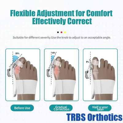 NIght Toe Bunion Splint Straightener Corrector, Foot Pain Relief Hallux Valgus Splint supplier